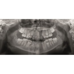 GENDEX GXDP-300 - цифровая панорамная рентгенодиагностическая система