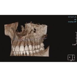 KaVo Pan eXam Plus 3D - цифровая панорамная рентгенодиагностическая система с функцией 3D-томографии 6x8 см и возможностью дооснащения модулем цефалостата