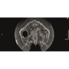 KaVo Pan eXam Plus 2D - датчик для панорамной рентгенодиагностики | KaVo (Германия)