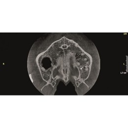 KaVo Pan eXam Plus 3D - цифровая панорамная рентгенодиагностическая система с функцией 3D-томографии 6x8 см и возможностью дооснащения модулем цефалостата