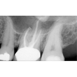 FONA CDR powered by SCHICK - система компьютерной стоматологической радиографии