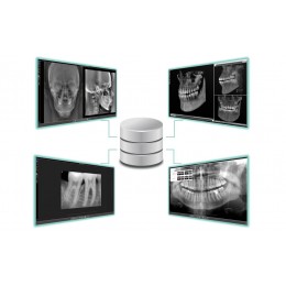 FONA Stellaris - система компьютерной стоматологической радиографии