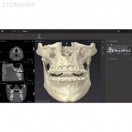 OP 3D Vision - аппарат панорамный рентгеновский стоматологический с функцией томографии