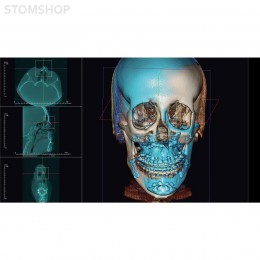 OP 3D Vision - аппарат панорамный рентгеновский стоматологический с функцией томографии