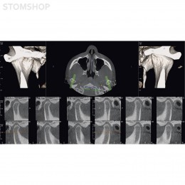 OP 3D Vision - аппарат панорамный рентгеновский стоматологический с функцией томографии