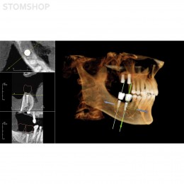 OP 3D Vision - аппарат панорамный рентгеновский стоматологический с функцией томографии