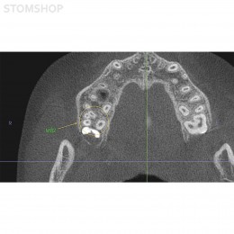 OP 3D Vision - аппарат панорамный рентгеновский стоматологический с функцией томографии