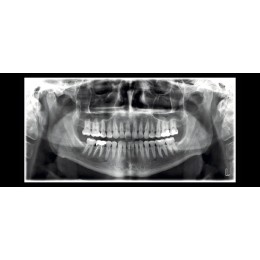 Planmeca ProMax 2D SCARA 2 - рентгеновская установка без цефалостата