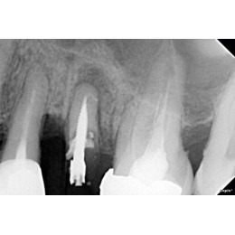 SOPIX2 - система компьютерной визиографии (стоматологический визиограф)