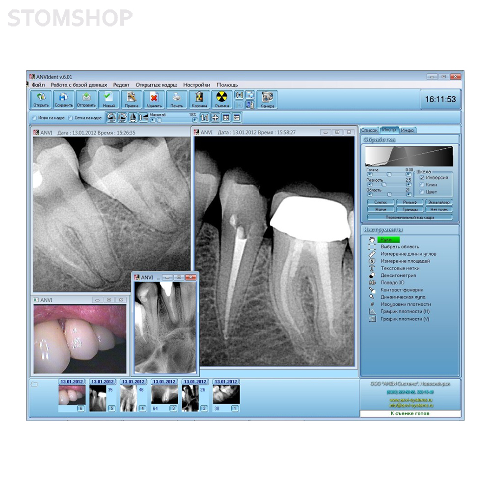 Анвизиограф - цифровой радиовизиограф | Купить по низкой цене  стоматологическое оборудование АНВИ Системс (Россия)