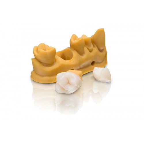 Varseo Smile Crown plus для печати постоянных реставраций | Bego (Германия)