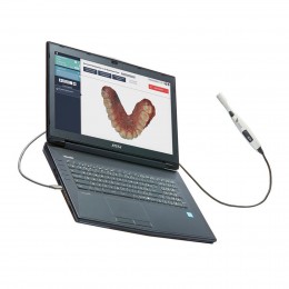 Condor - интраоральный сканер, ноутбук в комплекте