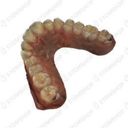 Condor - интраоральный сканер, ноутбук в комплекте