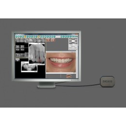 DEXIS Platinum - портативная цифровая рентгенографическая система