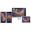 Exocad 2018 Valletta - программное обеспечение для компьютерного моделирования стоматологических реставраций | Exocad (Германия)
