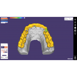 Exocad Bite Splint Module - модуль для создания терапевтических капп