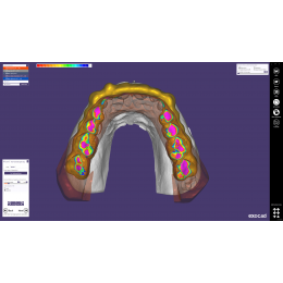 Exocad Bite Splint Module - модуль для создания терапевтических капп
