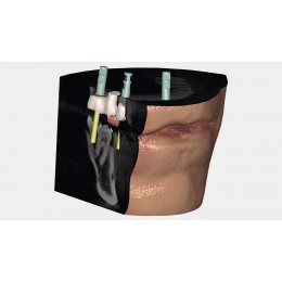 Exocad DICOM viewer - средство просмотра DICOM файлов