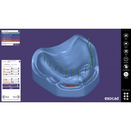 Exocad Full Denture Module - модуль для создания полносъемных протезов