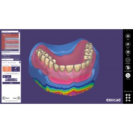Exocad Full Denture Module - модуль для создания полносъемных протезов
