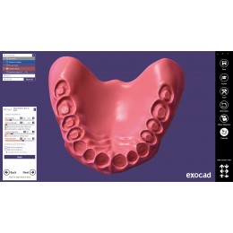 Exocad Full Denture Module - модуль для создания полносъемных протезов