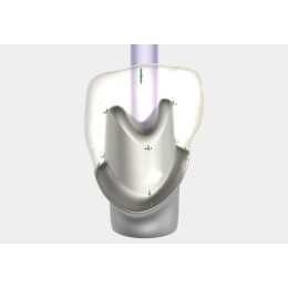 Exocad Implant Module - модуль для создания имплантов