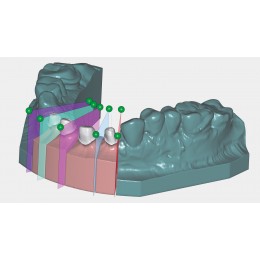 Exocad Model Creator - модуль для создания моделей