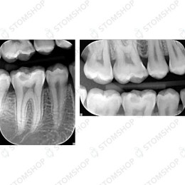 KaVo FOCUS - настенный дентальный рентгеновский аппарат