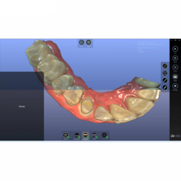 3Di IOS - цифровой сканер