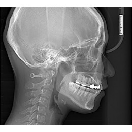 RAYSCAN Symphony Alpha PANO - ортопантомограф с возможностью дооснащения цефалостатом и компьютерным томографом