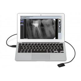 Mercury DIGISENS - цифровой радиовизиограф