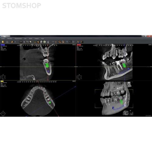 I-Max Touch 3D - цифровой панорамный рентгеновский аппарат | Owandy (Франция)