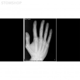 I-Max Touch 3D - цифровой панорамный рентгеновский аппарат