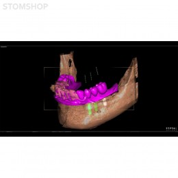 I-Max Touch 3D - цифровой панорамный рентгеновский аппарат