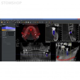 I-Max Touch 3D - цифровой панорамный рентгеновский аппарат