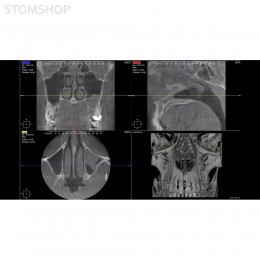 I-Max Touch 3D - цифровой панорамный рентгеновский аппарат