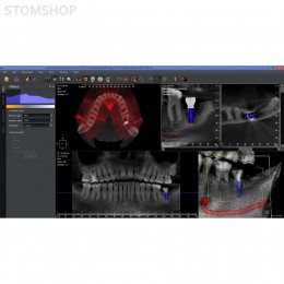 I-Max Touch 3D - цифровой панорамный рентгеновский аппарат