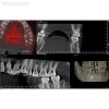 I-Max Touch 3D - цифровой панорамный рентгеновский аппарат | Owandy (Франция)
