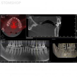 I-Max Touch 3D - цифровой панорамный рентгеновский аппарат