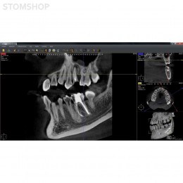 I-Max Touch 3D - цифровой панорамный рентгеновский аппарат