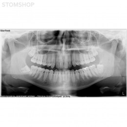 I-Max Touch Pano - цифровой панорамный рентгеновский аппарат