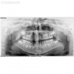 I-Max Touch Pano - цифровой панорамный рентгеновский аппарат