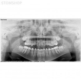 I-Max Touch Pano - цифровой панорамный рентгеновский аппарат