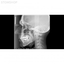 I-Max Touch Pano - цифровой панорамный рентгеновский аппарат