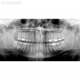 I-Max Touch Pano - цифровой панорамный рентгеновский аппарат