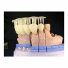 Phrozen Shuffle Lite - высокоточный 3D-принтер для стоматологии | Phrozen (Тайвань)