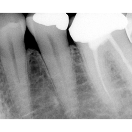 Dr.Suni Plus - система компьютерной радиовизиографии