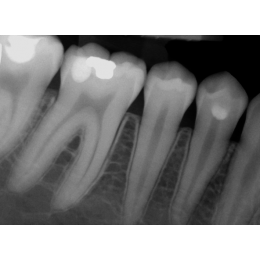 Dr.Suni Plus - система компьютерной радиовизиографии