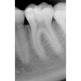 Dr.Suni Plus - система компьютерной радиовизиографии