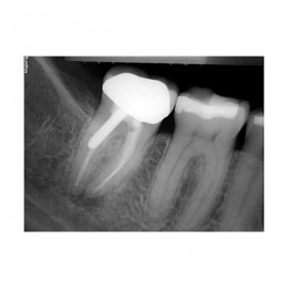 SuniRay2 - система компьютерной радиовизиографии